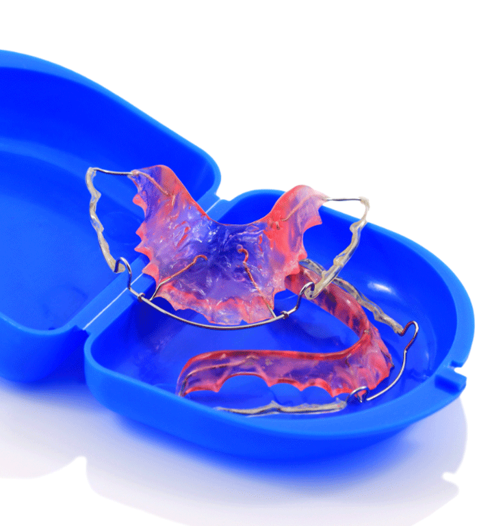 retainers in a blue travel case on white background