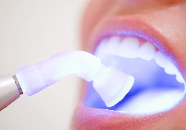soft tissue laser inside of patient's mouth